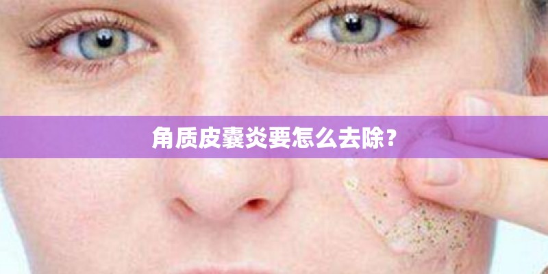 角质皮囊炎要怎么去除? 角质皮囊炎要怎么去除?